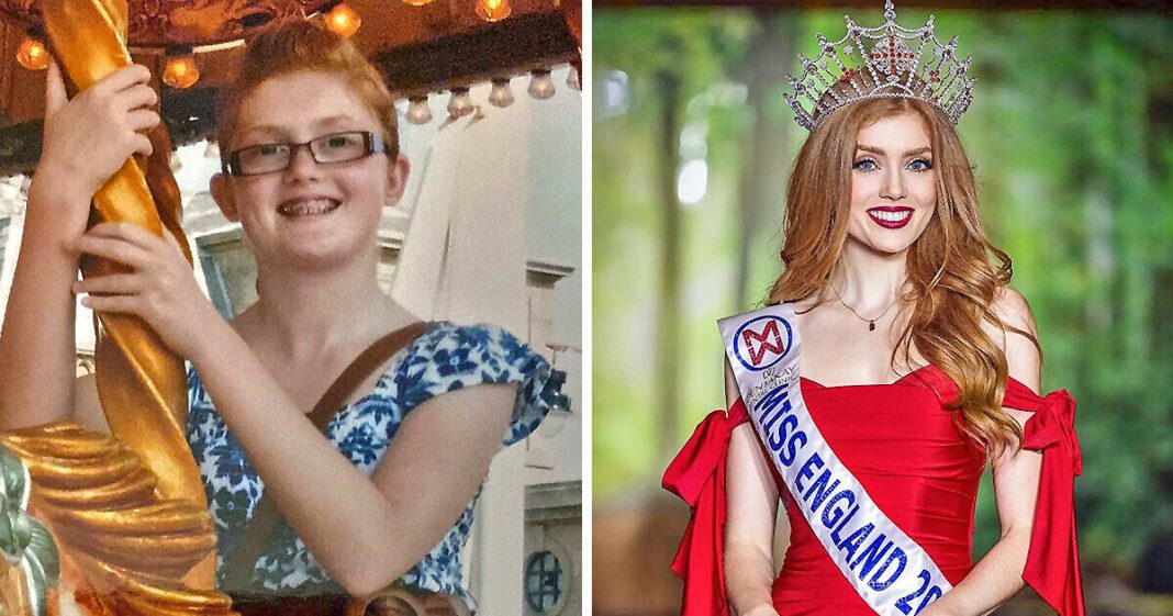 The Amazing Transformation of the First Redhead to Win the Miss England Crown
