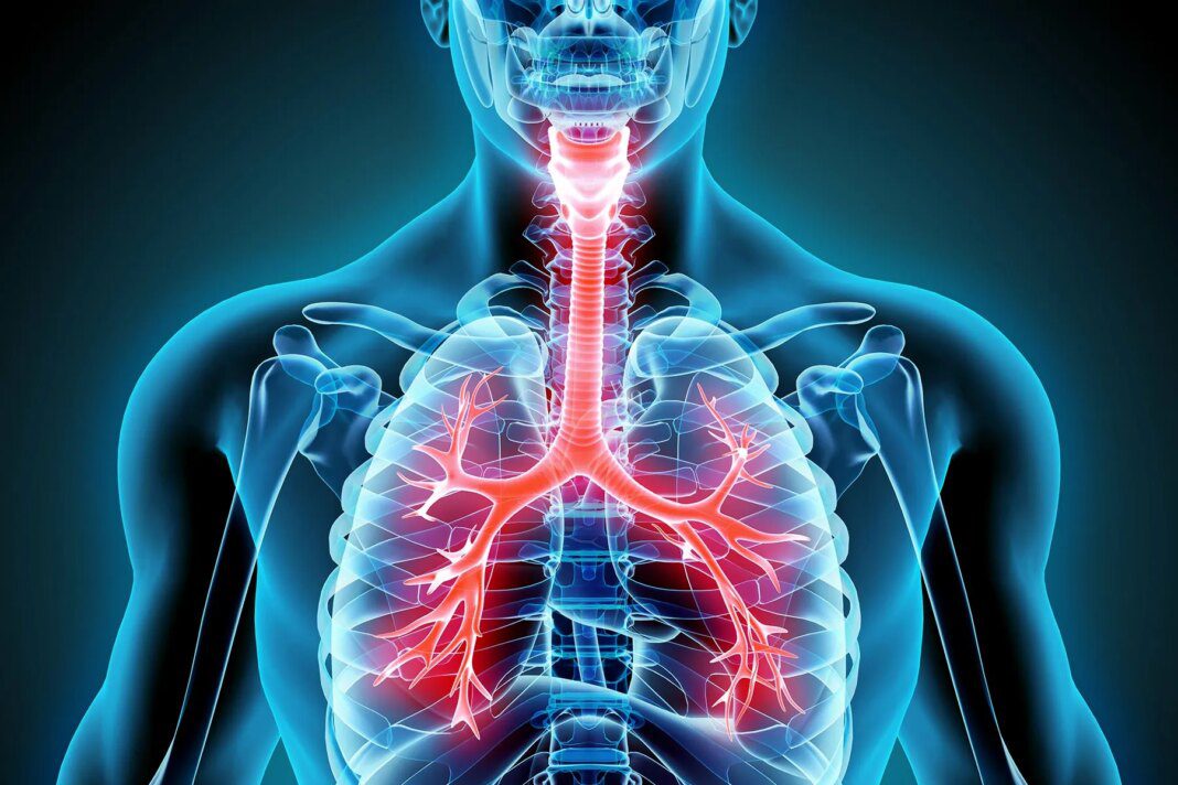 Peak Season: Brace for Multiple Respiratory Viruses in Early 2024