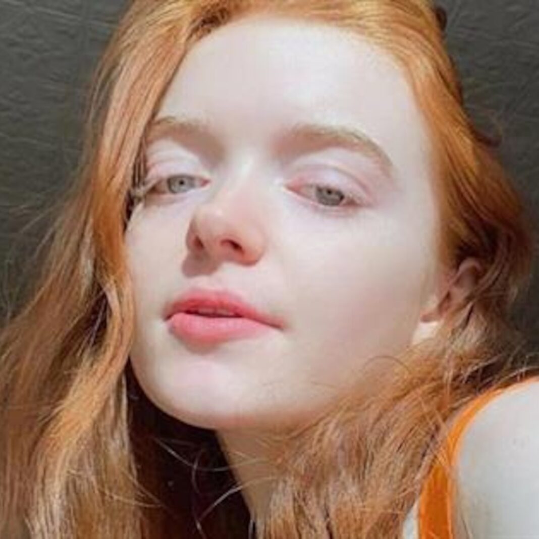Tragic Loss: 25-Year-Old Dancer Orla Baxendale Passes Away After Consuming Mislabeled Cookie