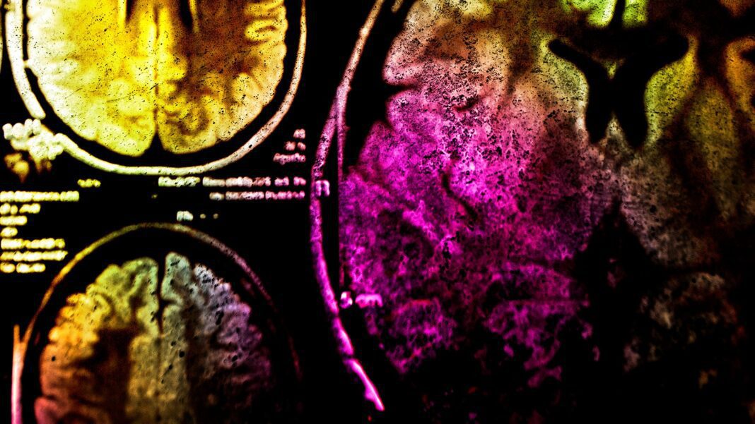 Scientists’ Concerns: The Growing Anxiety Around Neuralink
