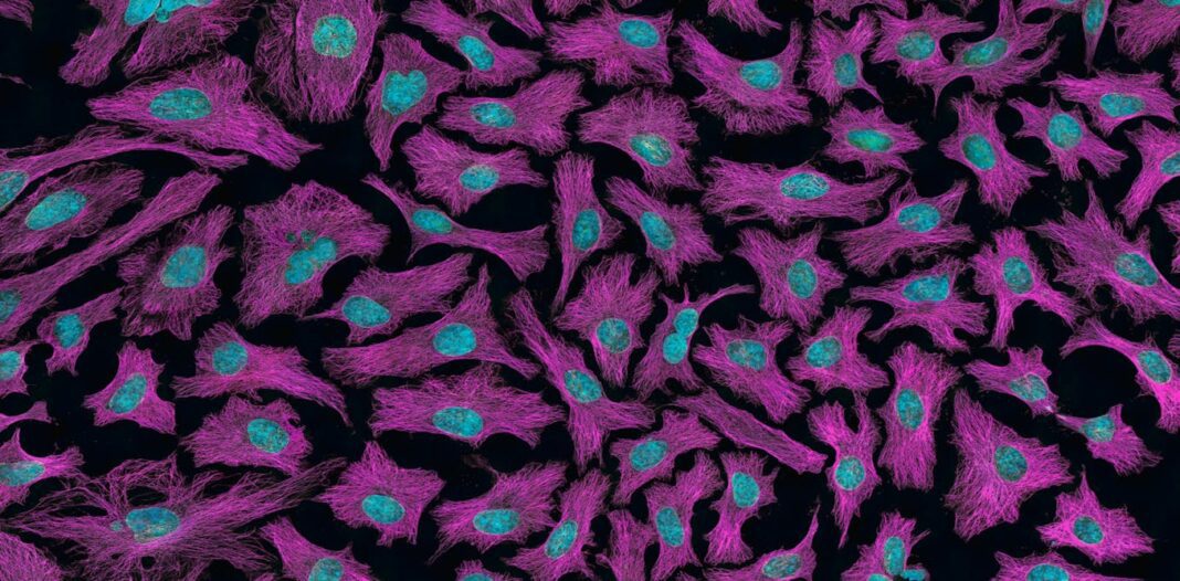 What’s the difference between a tumour and cancer?